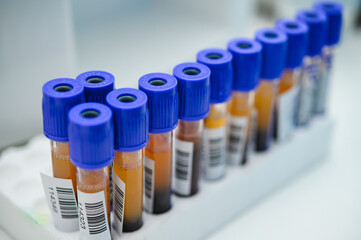 Test tubes in a rack. Research in the laboratory