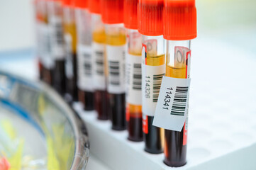 Test tubes in a rack. Research in the laboratory