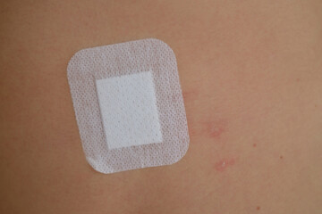Plaster On Wound