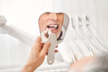 Patient chooses color of tooth enamel in his teeth