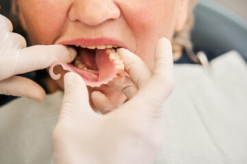 Dentist putting artificial teeth to patient mouth