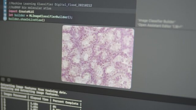 2.34 Real Neural Network Machine Learning Analyzes Bio Molecular Human Atlas Cellular Images Cell Dataset