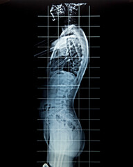 Radiografia