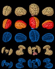 100 megapixels set - human brain with x-ray examination style image and highlighted zones isolated, mind discovery concept - digital detailed medical 3D illustration