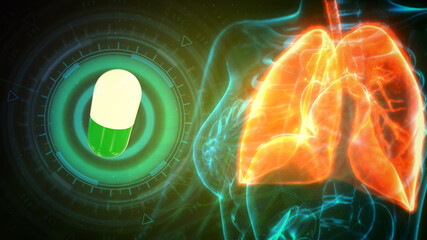 cg medicine 3d illustration, human lungs stricken by tablet