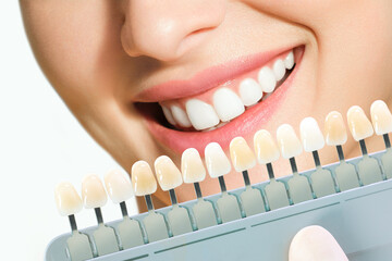 Smiling young woman. Cosmetological teeth whitening in a dental clinic. selection of the tone of...