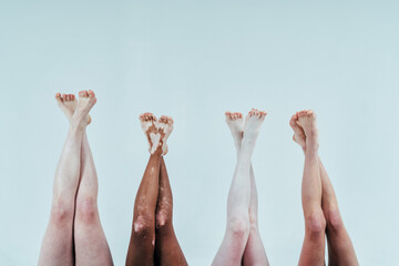 Group of multiethnic women with different kind of skin posing together in studio. Concept about body positivity and self acceptance