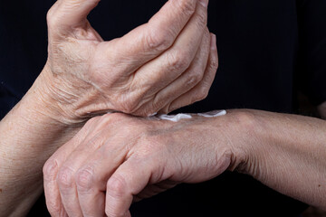 Elderly woman rubs nourishing cream in wrinkled hands close-up on black background