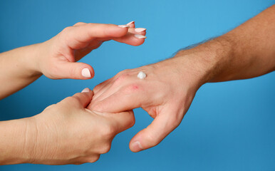 Hand skin care. The woman put the cream on man's weathered hand.