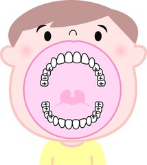 子供　歯列　口の中　イラスト