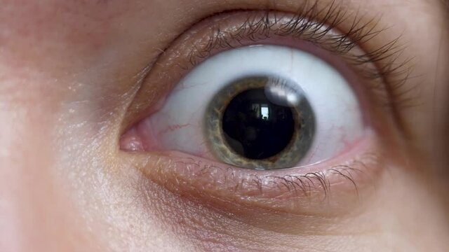 Cute female open grey eye, pupil with iris. Pretty woman smile, positive emotion. Natural skin no make up. Wrinkle around eye is fold, ridge or crease on skin. Cosmetology and skincare