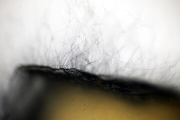 Microscope view of black fungus spore, molds or yeasts with close up macro 40x lens, contamination...