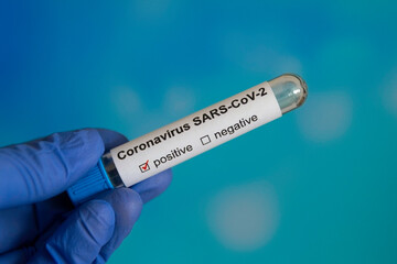 Fototapeta premium Coronavirus vaccine test negative positive in glass test tube covid on blue blue background children's hand