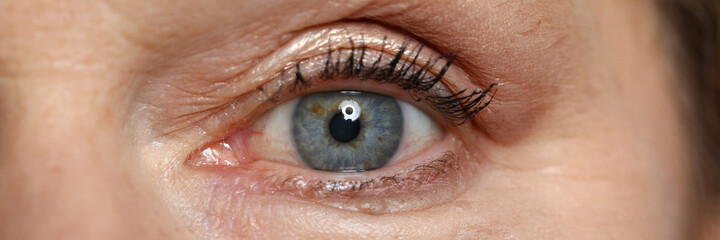 Blue eye of elderly woman look straight. Safe laser vision correction. Surgery to restore vision....