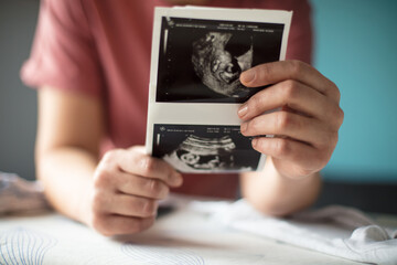 Pregnant woman holding a sonogram of her unborn baby.