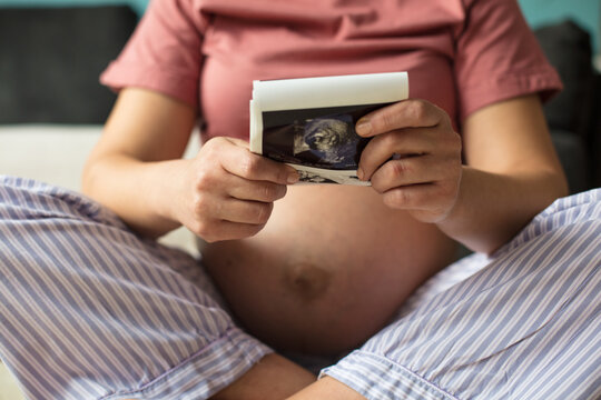 Pregnant Woman Holding A Sonogram Of Her Unborn Baby.