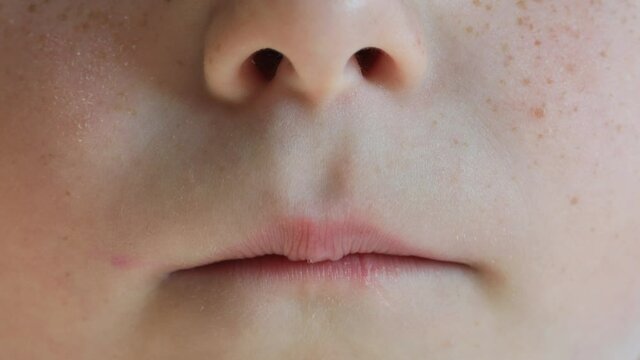 close-up of a child's face with lost front teeth