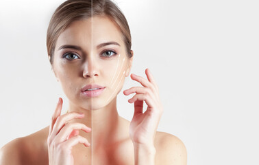 woman face wrinkles before and after treatment
