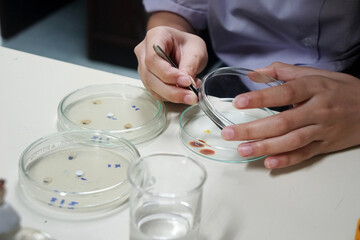 The hand was holding the filter paper tongs onto the prepared petri dish. Tests for the ability to inhibit microorganisms or bacteria in petri dishes by Disc diffusion techniques.