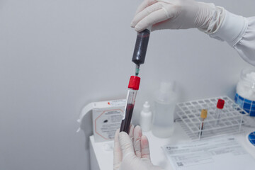 Hands of a laboratory technician transferring a patient's blood into a tube for analysis.