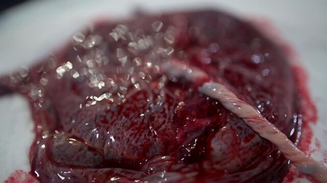 A closeup of a human placenta on bedsheets in the hospital shot in 4K