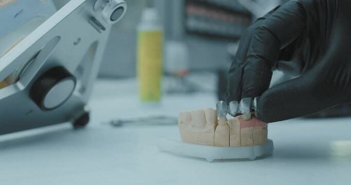 A model of artificial teeth is standing on the table surrounded by various dental devices, a dental technisian is putting artificial teeth painted in silver onto the model.