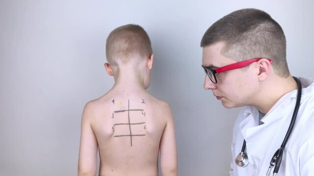 An allergist in the laboratory conducts an allergy prick-test. Skin test for household, food, epidermal allergic reactions. The test is performed on the patient's back. Child at a doctor's appointment
