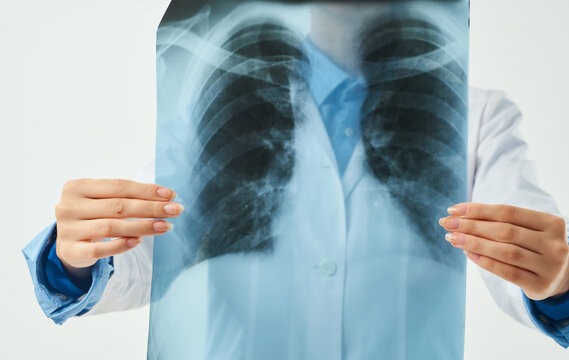 Professional doctor woman with chest x-ray in hands