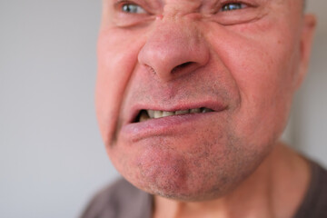 Obraz premium face of a European old man close-up, wrinkles on the aging skin, bares his teeth, makes grimaces, opening his mouth, the concept of mental health, cosmetology, age-related changes