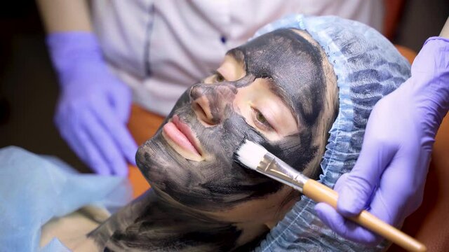 Dermatologist smears black mask on face for laser photorejuvenation and carbon peeling. Dermatology and cosmetology. Using surgical laser.