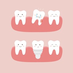 The process of tooth extraction and implantation. Cute сartoon teeth. Dental personage kawaii vector illustration. Isolated on pink background.