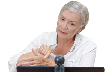 Teledermatology: elderly woman in front of a computer screen with webcam showing her doctor a mole...