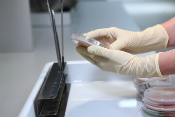 Containers with biological crops in the hands of a laboratory assistant. An unrecognizable person. Hand in protective gloves. A copy of the space.