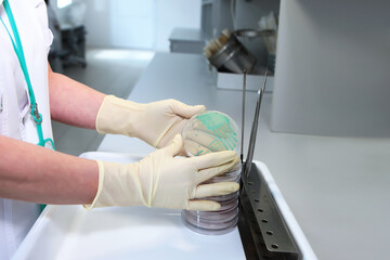 The laboratory assistant holds an open container with biological cultures in his hands. Hands in protective gloves. Clinical diagnostic laboratory.