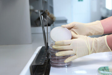An open container with biological cultures in the hands of a laboratory assistant. Hands in protective gloves. Clinical diagnostic laboratory. Scientific research work in the field of medicine.