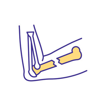 recommend clip art: Elbow fracture RGB color icon. Visible arm deformity. Broken bones. Sudden, intense pain. Joint surface damage. Nerve damage. Muscles sprains, strains and dislocations. Isolated vector illustration