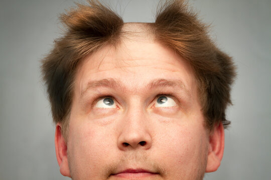 A man with a shaved stripe in the middle of his hair looking at his haircut with slanted eyes, funny face. Plain background. 