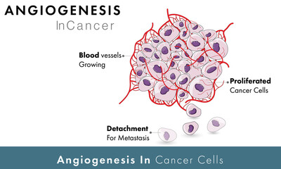 Cancer Cell angiogenesis vector graphic design  - obrazy, fototapety, plakaty