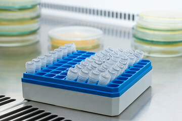 A blue rack with small white sample tubes stands on a chrome metal table in the laboratory among Petri dishes. Isolated samples for experiment.
