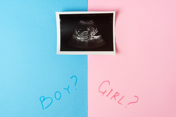 Image of baby in mother womb during ultrasound. Words BOY, GIRL and question mark on pink and blue background.