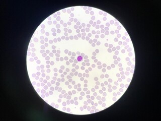 White blood cell lymphocyte on red blood cells background.