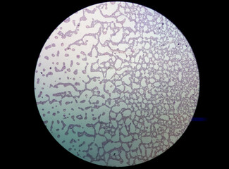 Microscopic view of hematology slide. RBC. WBC. closeup. Stained slide. Smear. Platelet