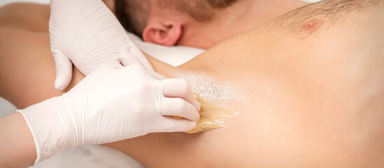 Obraz na płótnie Canvas Close up of hands in gloves of beautician waxing young male armpit with sugar paste in hair removal salon