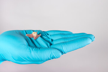 Dentist holding ceramic artificial false unit tooth. Dental prosthesis in gloved hands of the...