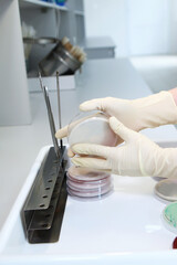 The laboratory assistant holds an open container with biological cultures in his hands. Hands in protective gloves. Clinical diagnostic laboratory. Research work in the field of medicine.