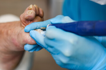 pedicure master in mask and goggles, polishes toenails close-up. Caring for the health of the legs and feet. Prepare open shoes for the summer. Relief from the pain of discomfort when walking