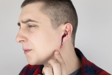 A man whose ear is bleeding. Vascular rupture, damage to the tympanic membrane, ear diseases,...