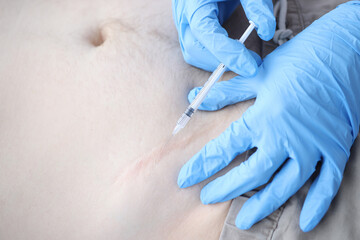 Nurse injecting medicine into patients postoperative scar closeup