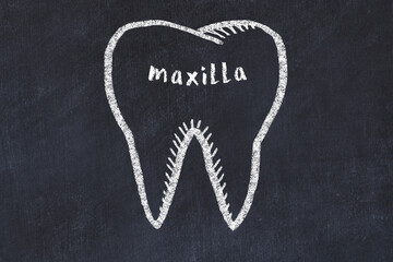 Chalk drawing of a tooth with medical term maxilla. Concept of learning stomatology © iushakovsky
