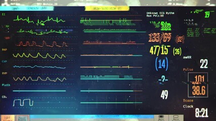 Glitching ICU monitor screen with patient's vital signs, paranormal events. Hospital horror scene